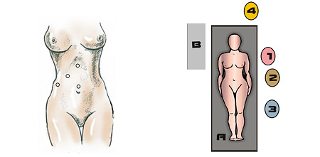 Киста почки фото