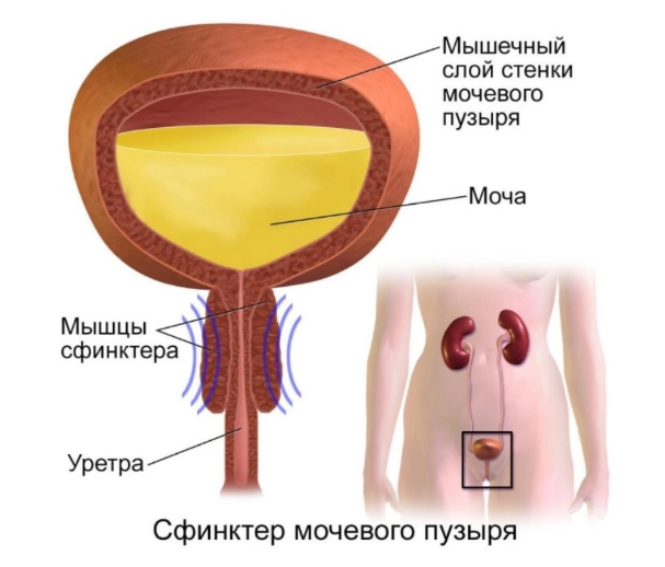 сфинктеропластика